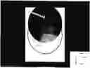 Fig. 01 - Imaging system and method for use in surgical and interventional medical procedures