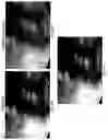 Fig. 03 - Imaging system and method for use in surgical and interventional medical procedures