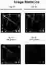 Fig. 07 - Imaging system and method for use in surgical and interventional medical procedures