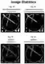 Fig. 08 - Imaging system and method for use in surgical and interventional medical procedures