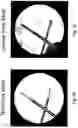 Fig. 09 - Imaging system and method for use in surgical and interventional medical procedures