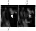 Fig. 12 - Imaging system and method for use in surgical and interventional medical procedures