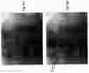 Fig. 13 - Imaging system and method for use in surgical and interventional medical procedures
