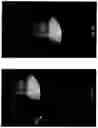 Fig. 14 - Imaging system and method for use in surgical and interventional medical procedures