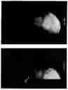 Fig. 15 - Imaging system and method for use in surgical and interventional medical procedures