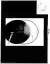 Fig. 16 - Imaging system and method for use in surgical and interventional medical procedures
