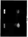 Fig. 17 - Imaging system and method for use in surgical and interventional medical procedures