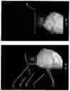 Fig. 18 - Imaging system and method for use in surgical and interventional medical procedures