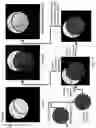 Fig. 20 - Imaging system and method for use in surgical and interventional medical procedures