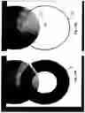 Fig. 21 - Imaging system and method for use in surgical and interventional medical procedures