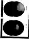 Fig. 22 - Imaging system and method for use in surgical and interventional medical procedures