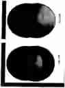 Fig. 23 - Imaging system and method for use in surgical and interventional medical procedures