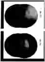Fig. 24 - Imaging system and method for use in surgical and interventional medical procedures