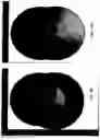 Fig. 25 - Imaging system and method for use in surgical and interventional medical procedures