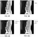 Fig. 06 - Systems and methods of automatic medical image labeling