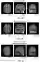 Fig. 07 - Systems and methods of automatic medical image labeling
