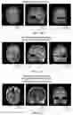 Fig. 08 - Systems and methods of automatic medical image labeling