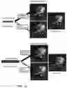 Fig. 02 - SPATIOTEMPORAL RESOLUTION ENHANCEMENT OF BIOMEDICAL IMAGES