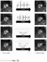 Fig. 03 - SPATIOTEMPORAL RESOLUTION ENHANCEMENT OF BIOMEDICAL IMAGES