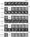 Fig. 11 - SPATIOTEMPORAL RESOLUTION ENHANCEMENT OF BIOMEDICAL IMAGES