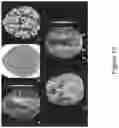 Fig. 16 - Identifying vessel occlusions using spatial patterns