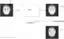 Fig. 01 - Image processing device and image processing method