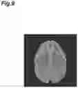 Fig. 10 - Image processing device and image processing method