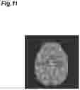 Fig. 12 - Image processing device and image processing method