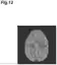 Fig. 13 - Image processing device and image processing method