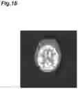 Fig. 17 - Image processing device and image processing method