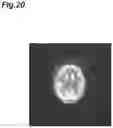 Fig. 21 - Image processing device and image processing method