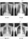 Fig. 20 - Systems and methods for image processing