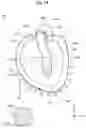 Fig. 15 - HEART SIMULATOR