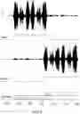 Fig. 05 - Method and system for conversation transcription with metadata