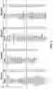 Fig. 20 - Methods For Identifying Complex Disease Subtypes