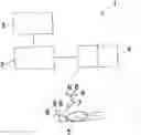 Fig. 01 - Radiotherapy feedback device