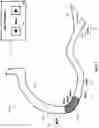 Fig. 15 - Percutaneous coronary intervention (PCI) planning interface and associated devices, systems, and methods