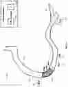 Fig. 17 - Percutaneous coronary intervention (PCI) planning interface and associated devices, systems, and methods