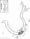 Fig. 19 - Percutaneous coronary intervention (PCI) planning interface and associated devices, systems, and methods