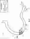 Fig. 21 - Percutaneous coronary intervention (PCI) planning interface and associated devices, systems, and methods