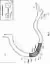 Fig. 23 - Percutaneous coronary intervention (PCI) planning interface and associated devices, systems, and methods
