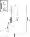 Fig. 26 - Percutaneous coronary intervention (PCI) planning interface and associated devices, systems, and methods