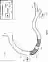 Fig. 27 - Percutaneous coronary intervention (PCI) planning interface and associated devices, systems, and methods