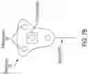 Fig. 16 - Radio-frequency systems and methods for co-localization of medical devices and patients