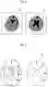 Fig. 04 - Medical image processing apparatus, method, and program