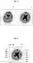 Fig. 05 - Medical image processing apparatus, method, and program