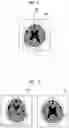 Fig. 07 - Medical image processing apparatus, method, and program