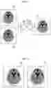 Fig. 08 - Medical image processing apparatus, method, and program