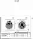 Fig. 09 - Medical image processing apparatus, method, and program