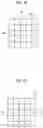 Fig. 13 - Medical image processing apparatus, method, and program